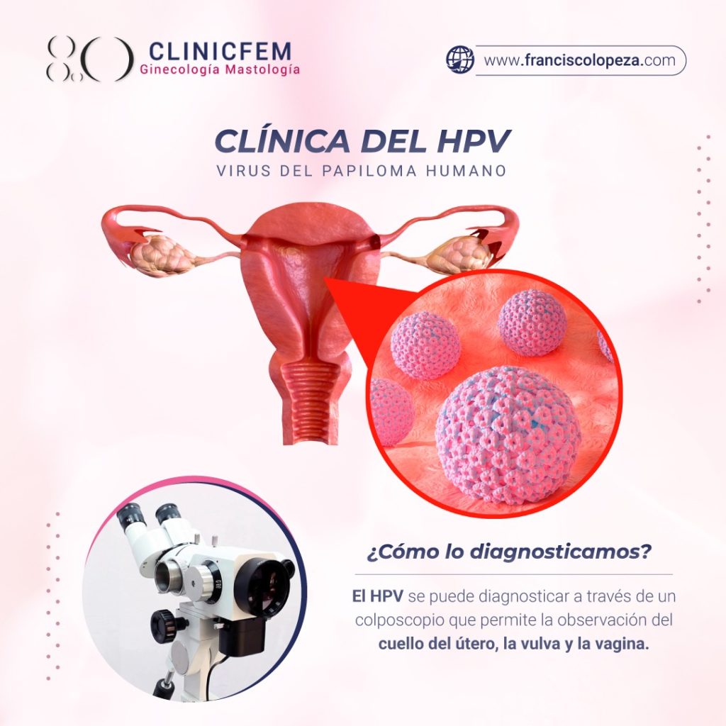 Clínica Del Vph Y Colposcopía Clinicfem 8624